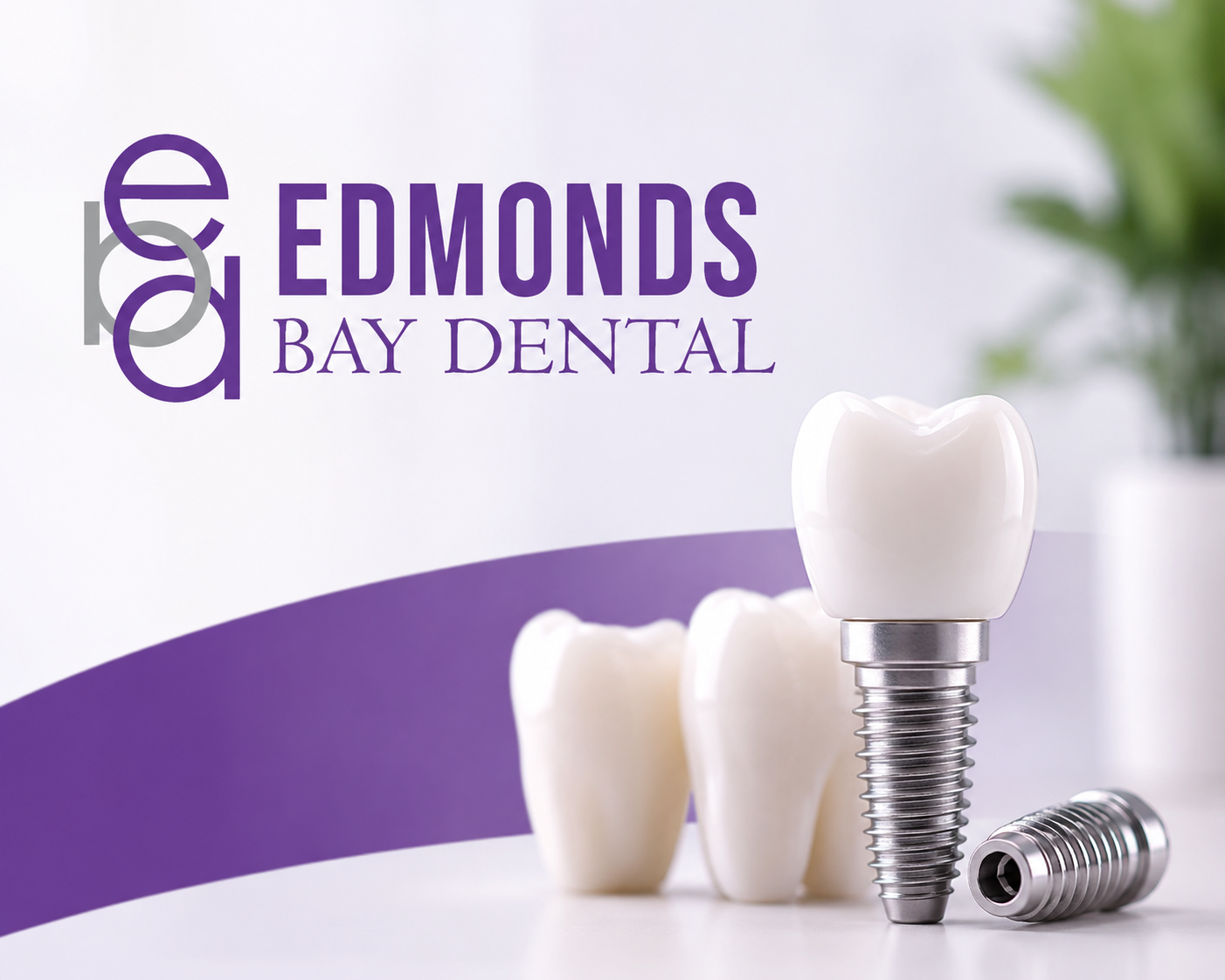 Dental Implants in Edmonds WA